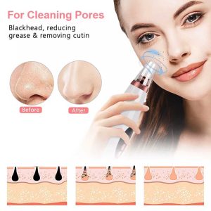 f15f35cb1235ced4e0962f37c83507e9.jpg White Multi Functional Cleaning Blackheads Remover, For Personal, Normal Skin