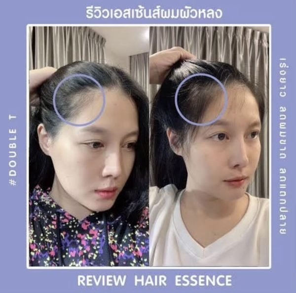 Double T Hair Essence Serum Treatment Dry Damage Long Growth Hair Loss 30ml
