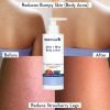 WishCare 10% AHA + 1% BHA Body Lotion Glycolic Body Lotion-200ml