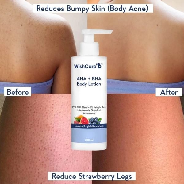 WishCare 10% AHA + 1% BHA Body Lotion Glycolic Body Lotion-200ml
